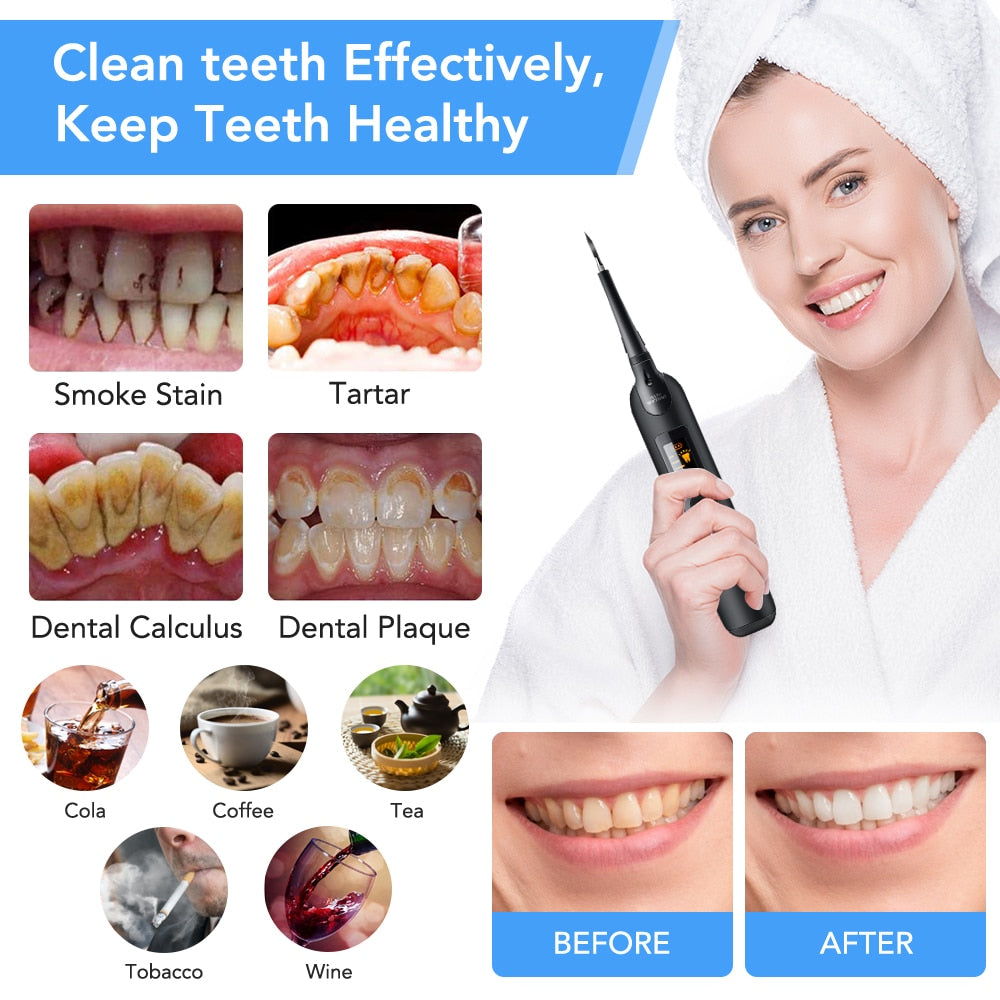 Portable Electric Sonic Dental Scaler Tooth Calculus Remover LCD Display Whiten Teeth Scaler Tartar Plaque Remover for Teeth